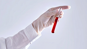 콜레스테롤 검사